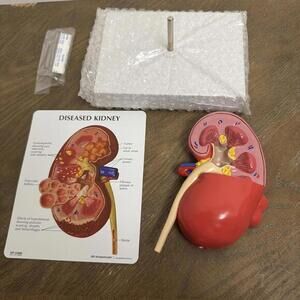 GPI Anatomicals Diseased Kidney Cancer  Medical Training Aid Anatomy Model #3260
